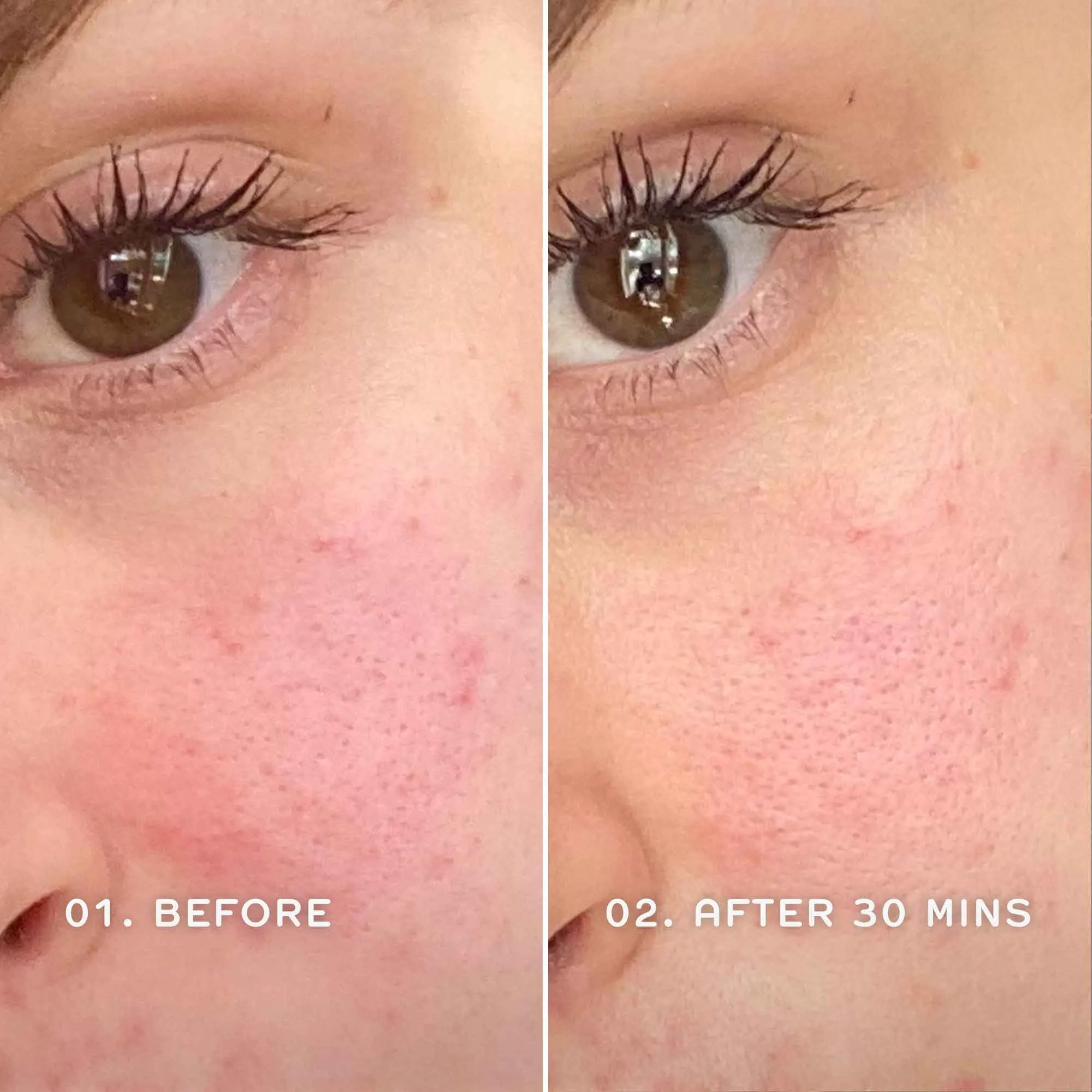 Evercalm™ Redness Relief Serum (Your Gift - $60 Value)